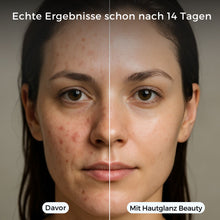 Carica l'immagine nel visualizzatore di Gallery, Hautglanz Beauty Soffione doccia - pelle visibilmente più bella